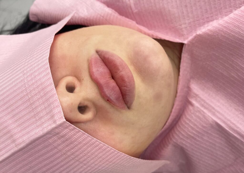 Hayley Nicole Treatments